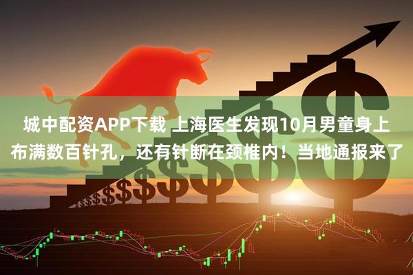 城中配资APP下载 上海医生发现10月男童身上布满数百针孔，还有针断在颈椎内！当地通报来了